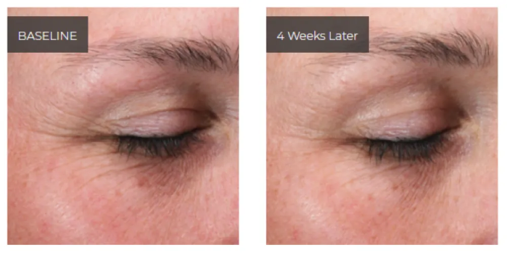 Emepelle Eye Cream
