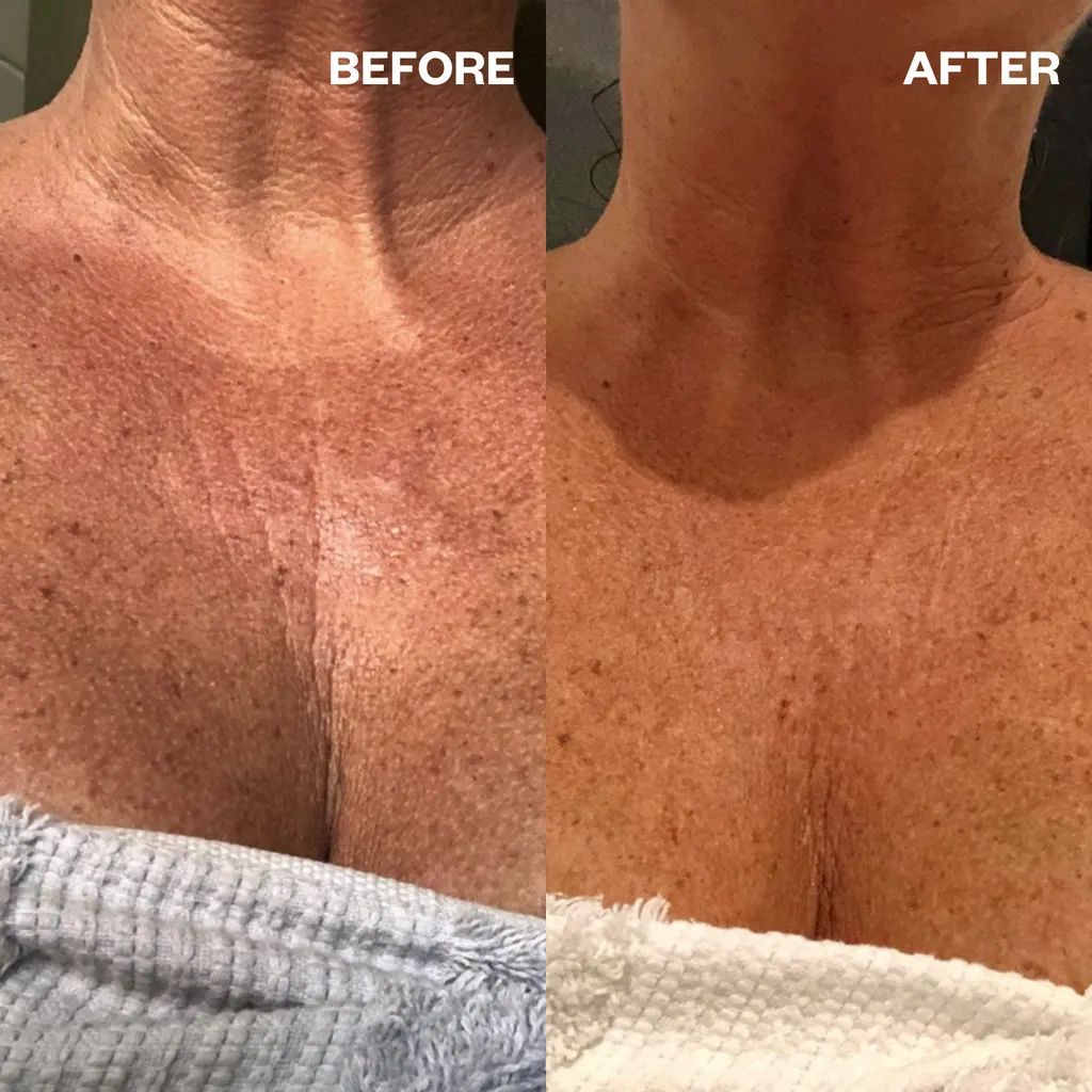 InfuseFAST Decolletage Bicellulose Sheet Mask - single mask | Wrinkles Schminkles